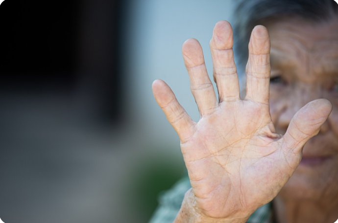 Elder Abuse Signs